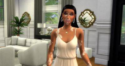 Victoria Kennedy - Free Sims 4 update adds Vitiligo skin details with Winnie Harlow collaboration - eurogamer.net